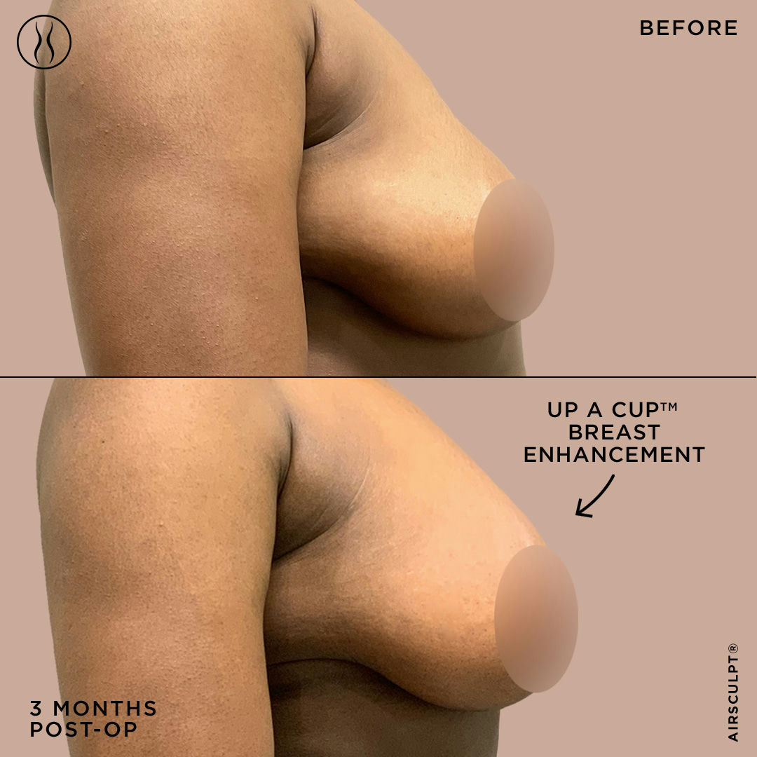 charlie mcclafferty recommends Big Teardrop Titties